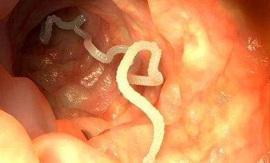 causas de parasitas no corpo humano