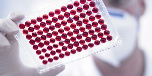 exame de sangue para vermes