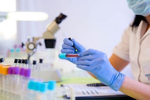 exame de sangue para parasitas